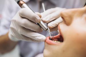 Địa chỉ nhổ răng khôn uy tín, an toàn nhất Lạng Sơn