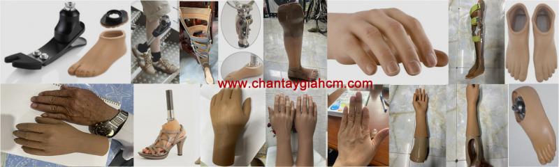 Chân tay giả Hùng Xuân