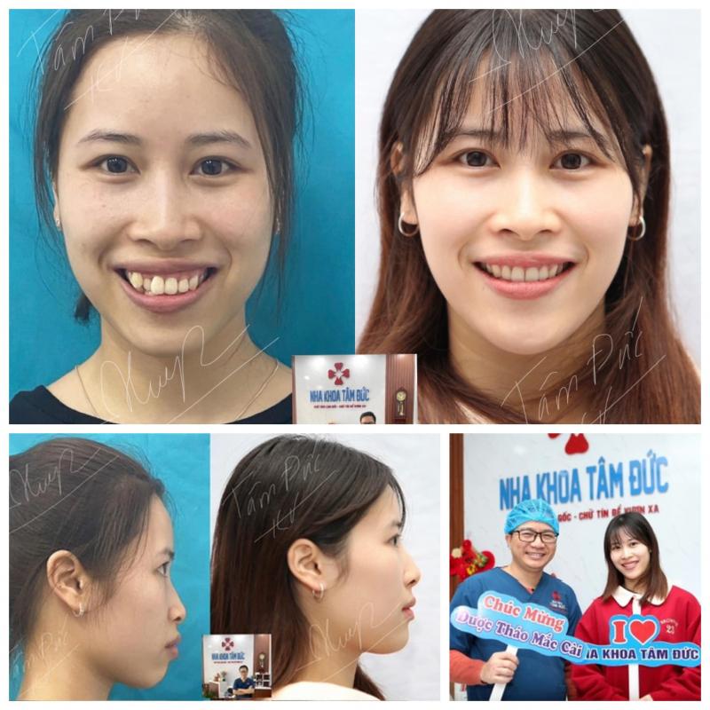 Nha Khoa Tâm Đức